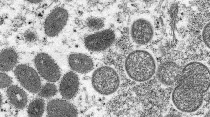 Virus Cacar Monyet Mengancam Dunia