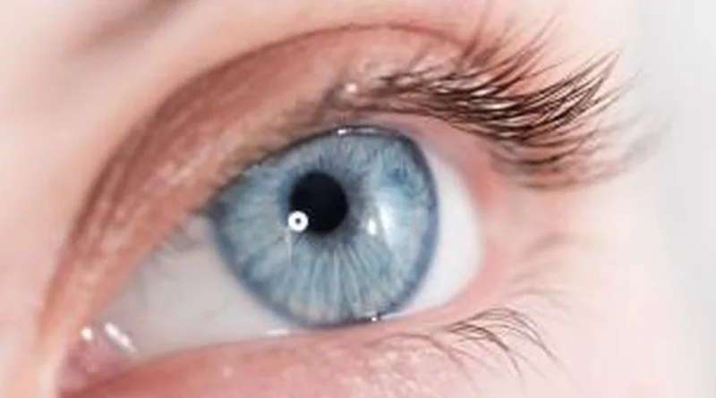 merawat mata ketika telah lasik