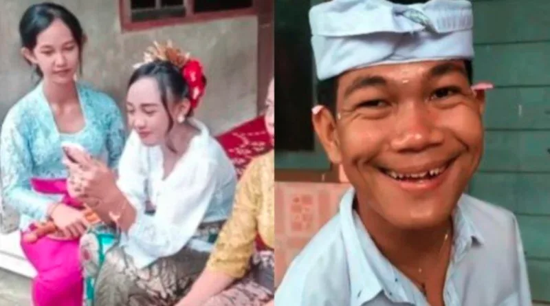 Agus No Hand Menikah